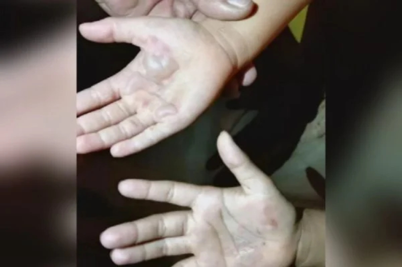 mae-queima-maos-filhas-rio-verde-goias-600x400