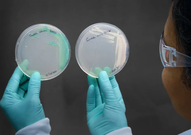 101990928-an-image-provided-by-the-centers-for-disease-control-and-prevention-shows-cultured-candida(1)