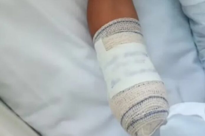 Criança perde a mão após confundir bomba com peça de bicicleta no Rio