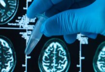 UFABC desenvolve composto promissor Contra Alzheimer