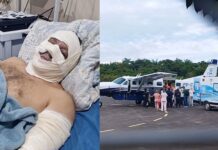 Ex-prefeito de Borba, Simão Peixoto sofre grave acidente em explosão de lancha e é transferido para Manaus