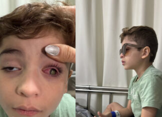 Mãe mobiliza redes sociais e arrecada valor para cirurgia urgente no olho do filho de 6 anos em Manaus