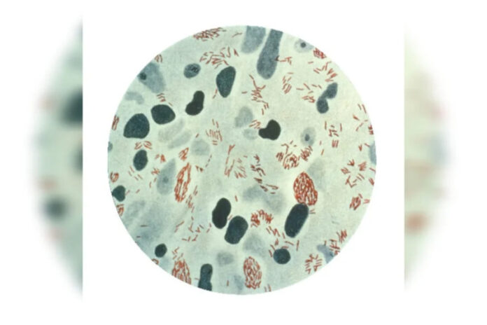 af94dff6-bacilo-de-hensen-da-lepra-hanseniase