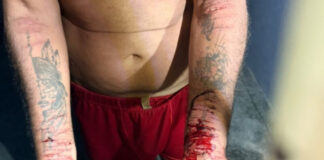 “Foi para se fazer de vítima”, diz delegado sobre cortes no braço de pai acusado de matar filho de 3 anos em Manaus