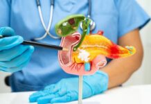 Nova descoberta dá esperança para o tratamento de câncer de pâncreas